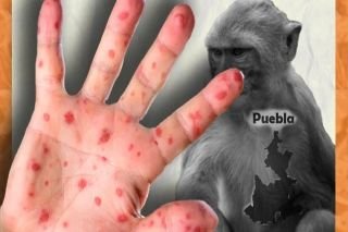 Secretario de Salud de Puebla, aseguró que homosexuales &quot;tienen mayor riesgo&quot; de contagio de viruela del mono