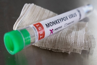 OMS pide respuesta “urgente” de Europa ante aumento de casos de viruela del mono